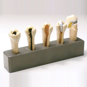 modelo anatómico de dientes 1
