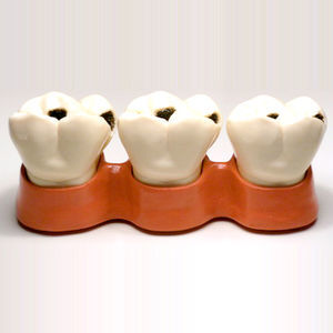 modelo anatómico de dientes 1