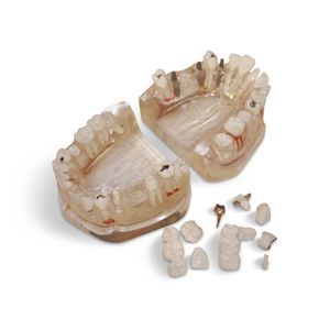 modelo anatómico de dientes