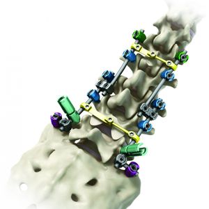 sistema de osteosíntesis toraco-lumbo-sacro