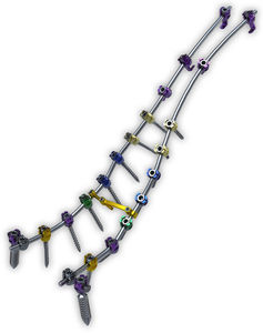 sistema de osteosíntesis toraco-lumbo-sacro