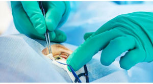 kit médico para cirugía oftalmológica