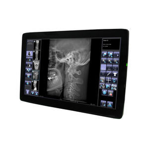 sistema de adquisición para radiología 1