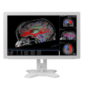 monitor para imágenes médicas