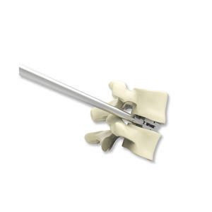caja intersomática lumbar