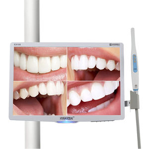 cámara intraoral