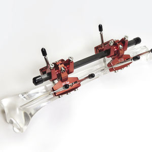fijador externo tubular 1
