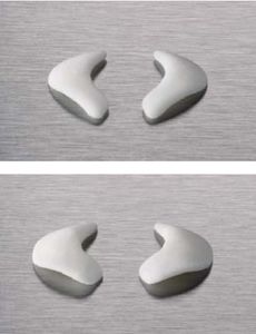 implante nasal