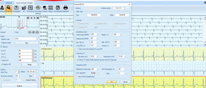 software para ECG