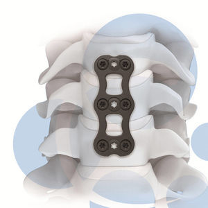 placa de artrodesis cervical 1