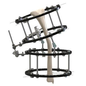 fijador externo para tibia 1