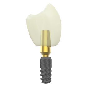 implante dental cónico 1