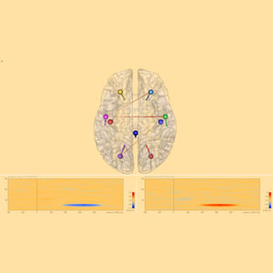 software para EEG