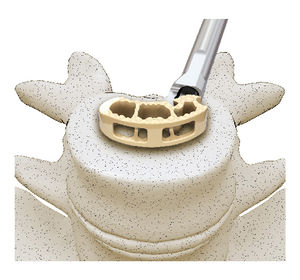 caja intersomática lumbar