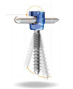 tornillo pedicular lumbar