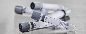 tubo de extracción para el análisis de la glucemia 1