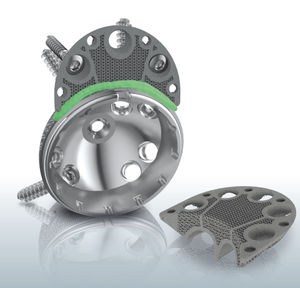 prótesis acetabular cementada