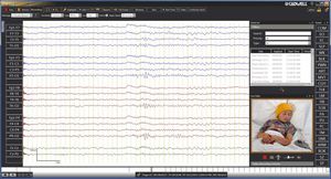 software de control / de monitorización / de captura / para EEG