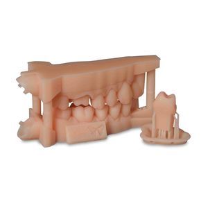 material dental de resina