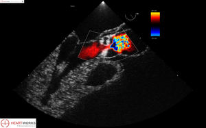 módulo de software para ecocardiografía