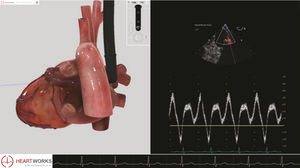 módulo de software para ecocardiografía