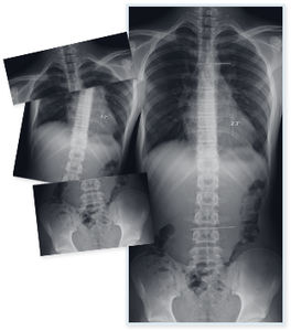 software de radiografía