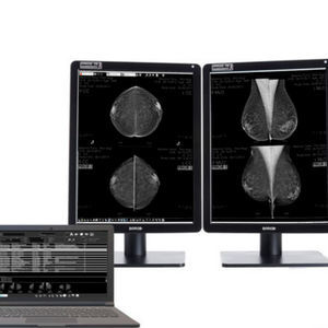software para mamografía