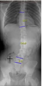 software de radiografía