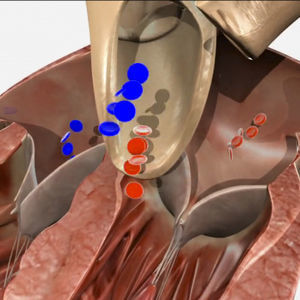 módulo de simulación para ecocardiografía