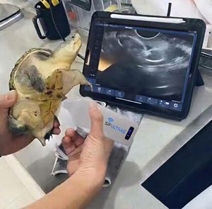 ecógrafo de mano