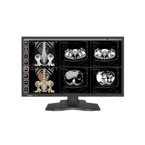 monitor para imágenes médicas