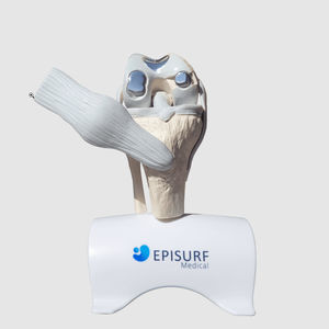 implante de rodilla