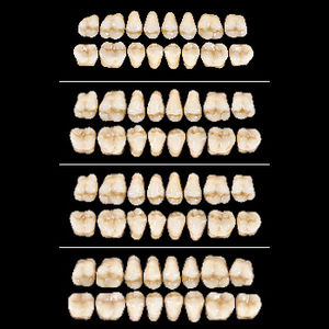 prótesis dental de fibra acrílica