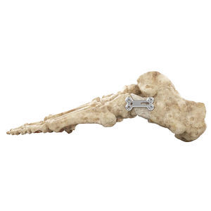placa de osteotomía para hallux valgus 1