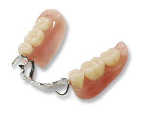 prótesis dental de los dientes anteriores 1