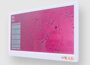 monitor de alta definición 1