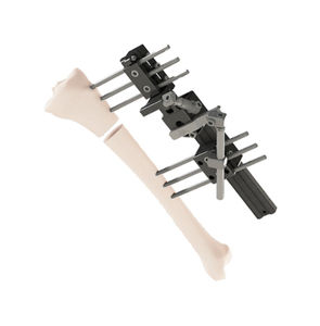 fijador externo para tibia
