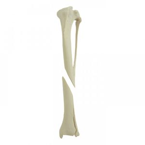 modelo anatómico de tibia