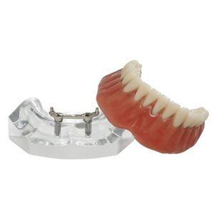 modelo anatómico de dentadura