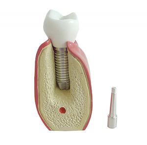 modelo anatómico para odontología