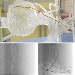 modelo anatómico de arterias coronarias 1