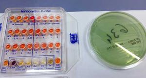 kit de prueba para análisis de identificación / de susceptibilidad antimicrobiana / Mycoplasma / de Gardnerella vaginalis