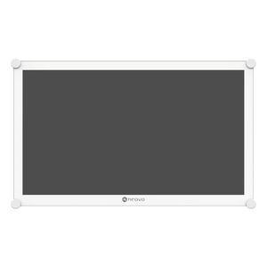 monitor médico 1