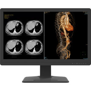 monitor 3.840x 2.160