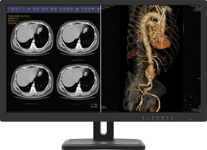 monitor 31.5