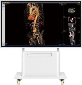 monitor 3.840x 2.160
