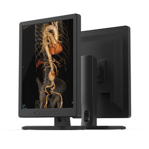 monitor de diagnóstico