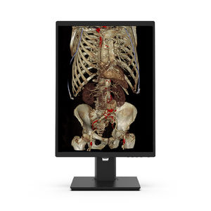 monitor de diagnóstico