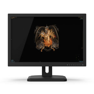 monitor de diagnóstico