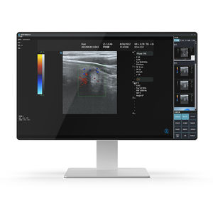 ordenador médico Intel® Core i7